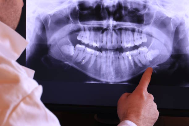 Best Root Canal Emergency Dentist  in Somerville, NJ
